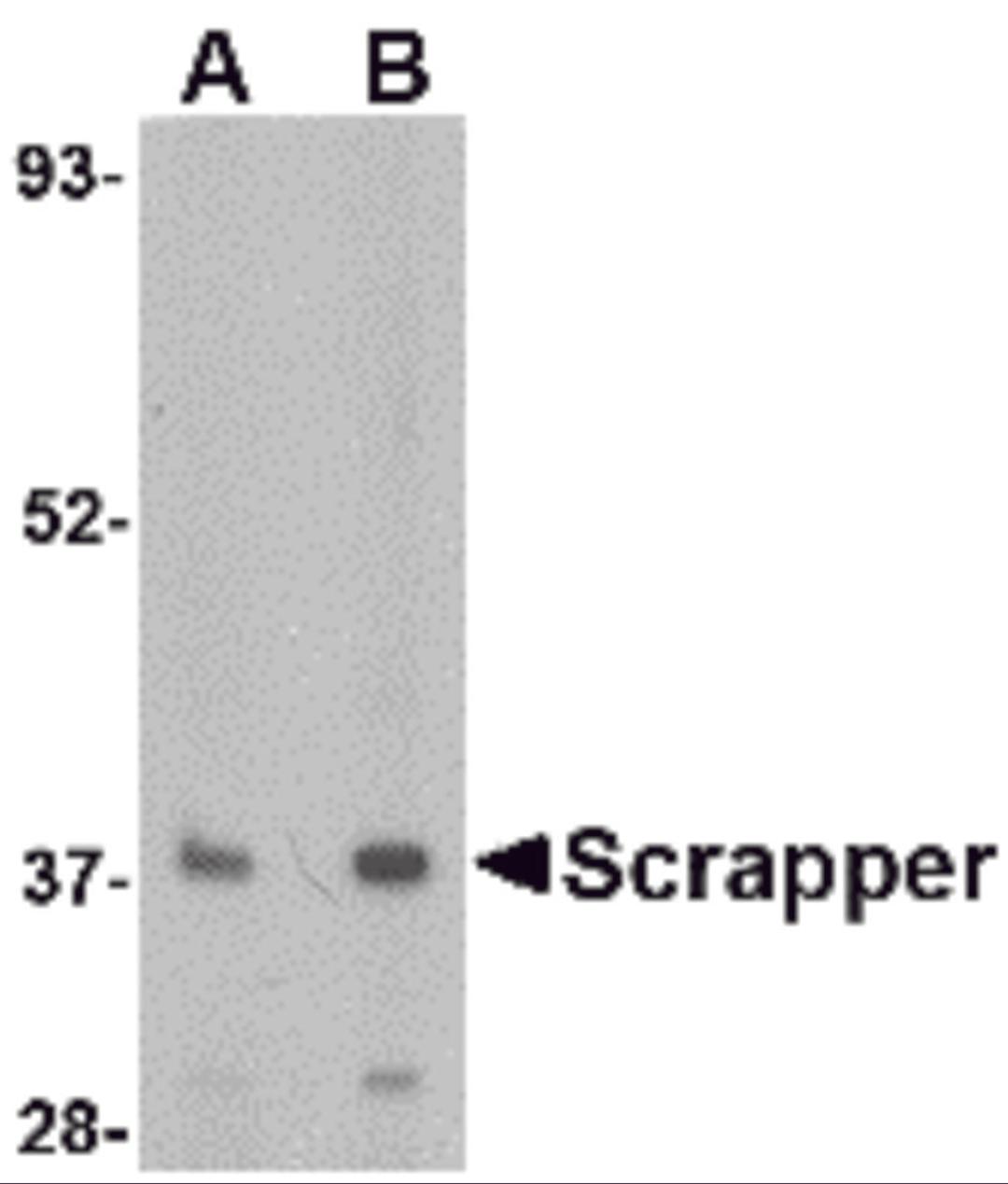 Western blot analysis of SCRAPPER in A20 cell lysate with SCRAPPER antibody at (A) 0.5 and (B) 1 &#956;g/mL.