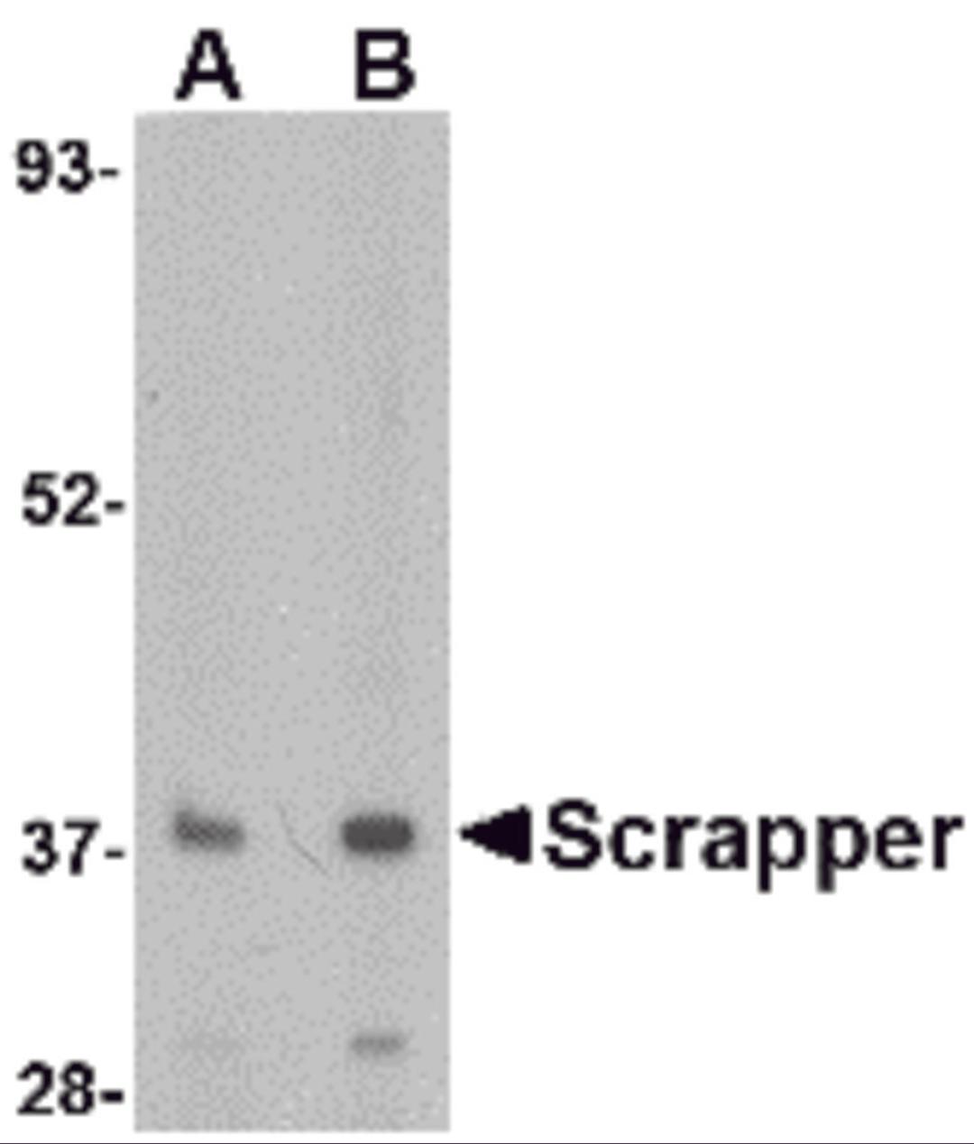 Western blot analysis of SCRAPPER in A20 cell lysate with SCRAPPER antibody at (A) 0.5 and (B) 1 μg/mL.