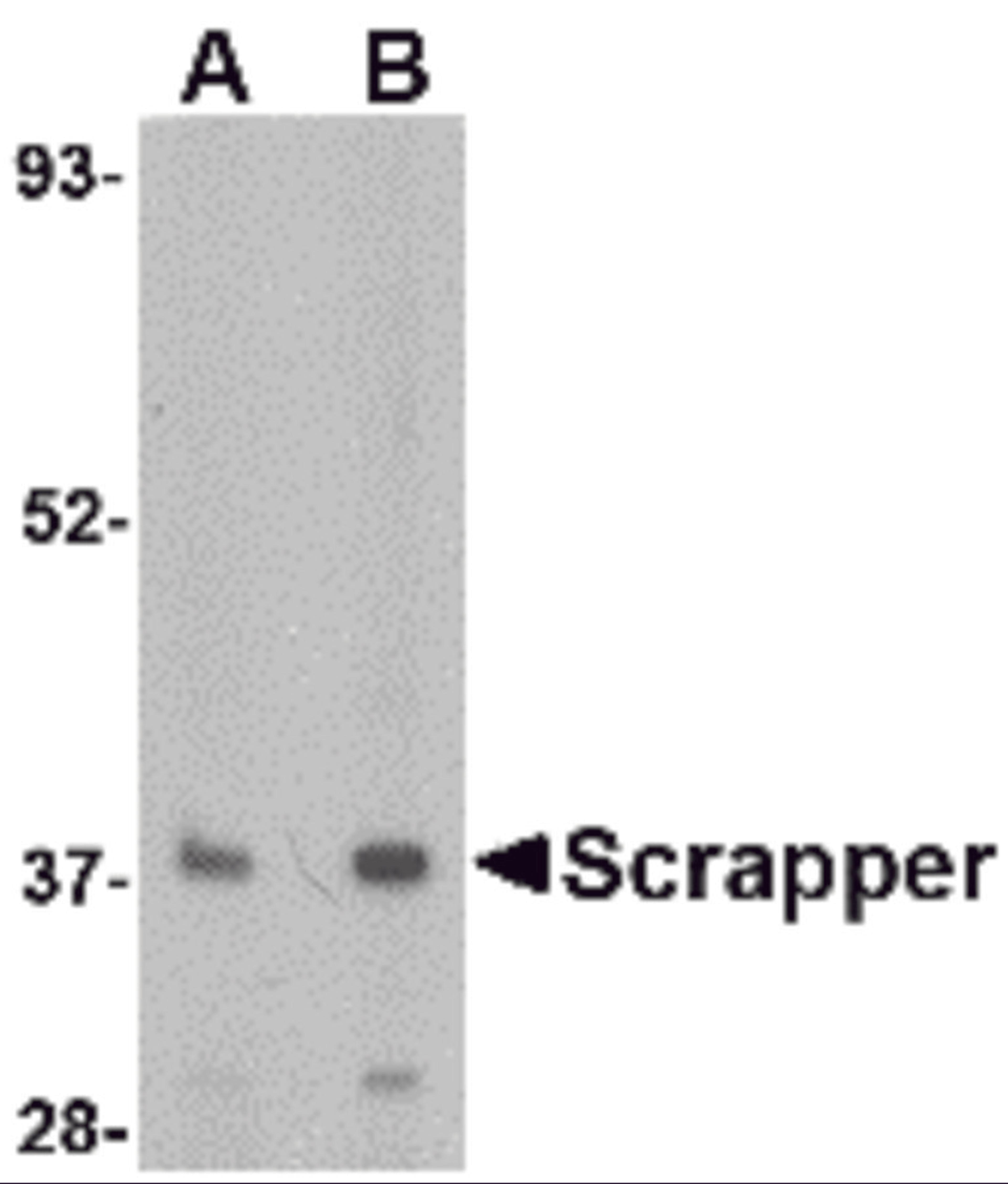 Western blot analysis of SCRAPPER in A20 cell lysate with SCRAPPER antibody at (A) 0.5 and (B) 1 μg/mL.