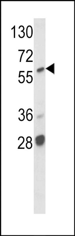 Western blot analysis of hARAF1-H270 in MCF7 cell line lysates (35ug/lane)