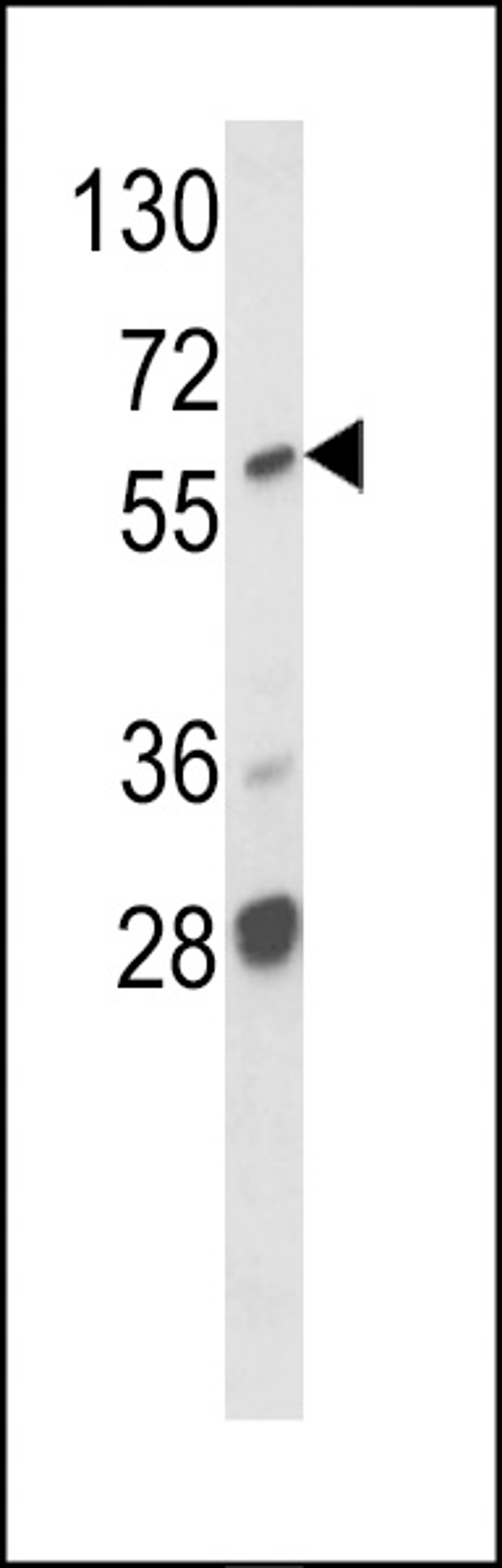 Western blot analysis of hARAF1-H270 in MCF7 cell line lysates (35ug/lane)