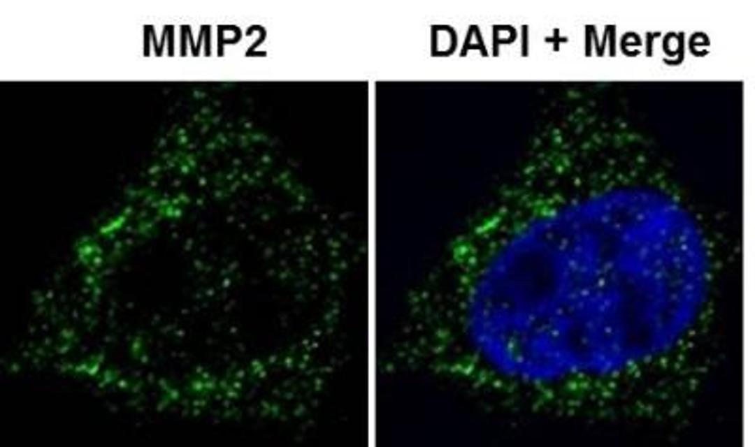 Immunocytochemistry/Immunofluorescence: MMP-2 Antibody [NB200-193] - analysis of MMP-2 in HeLa cells using anti-MMP-2 antibody. Image from verified customer review.