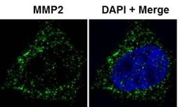 Immunocytochemistry/Immunofluorescence: MMP-2 Antibody [NB200-193] - analysis of MMP-2 in HeLa cells using anti-MMP-2 antibody. Image from verified customer review.