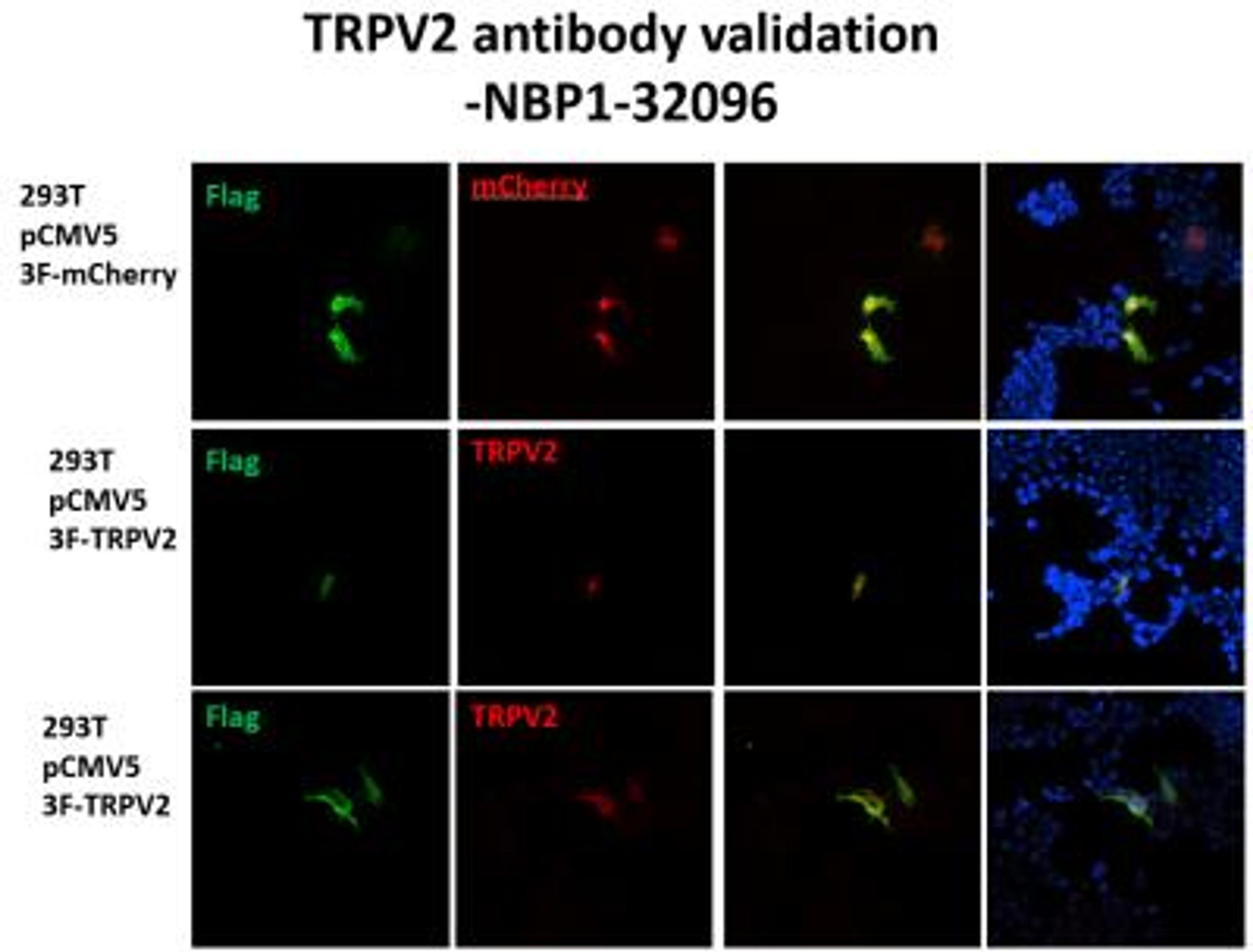 Immunocytochemistry/Immunofluorescence: VRL1 Antibody [NBP1-32096] - 293T cells transfected with vector, pCMV5 3xFlag-mCherry, as positive control. mCherry was co-localized with Flag.  293T cells transfected with vector, pCMV5 3xFlag-TRPV2, as experimental group. TRPV2 was co-localized with Flag at cell membrane.  ICC  Flag: green  TRPV2: red  Nucleus: blue  mCherry: red fluorescent protein