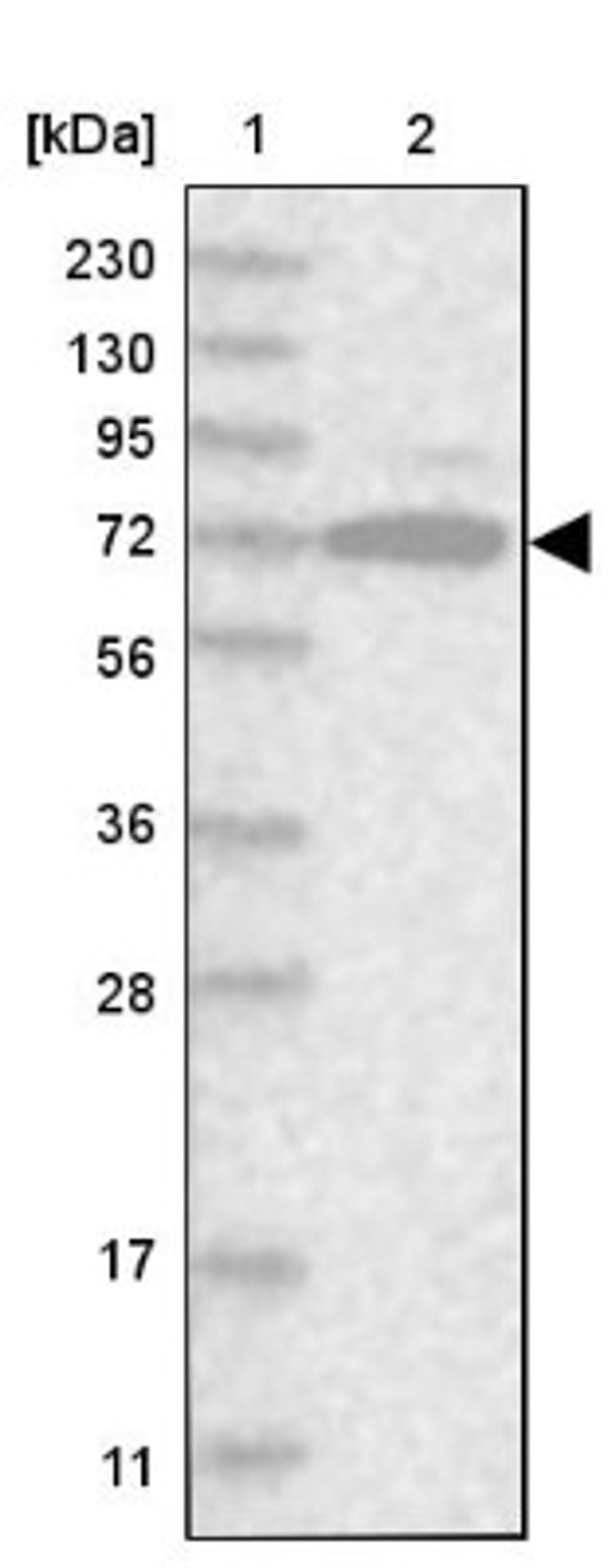 Western Blot: ACRC Antibody [NBP1-85993] - Lane 1: Marker [kDa] 230, 130, 95, 72, 56, 36, 28, 17, 11<br/>Lane 2: Human cell line RT-4