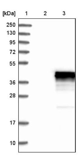 Western Blot: CDCA3 Antibody [NBP1-83332] - Lane 1: Marker [kDa] 250, 130, 95, 72, 55, 36, 28, 17, 10<br/>Lane 2: Negative control (vector only transfected HEK293T lysate)<br/>Lane 3: Over-expression lysate (Co-expressed with a C-terminal myc-DDK tag (~3.1 kDa) in mammalian HEK293T cells, LY410572)