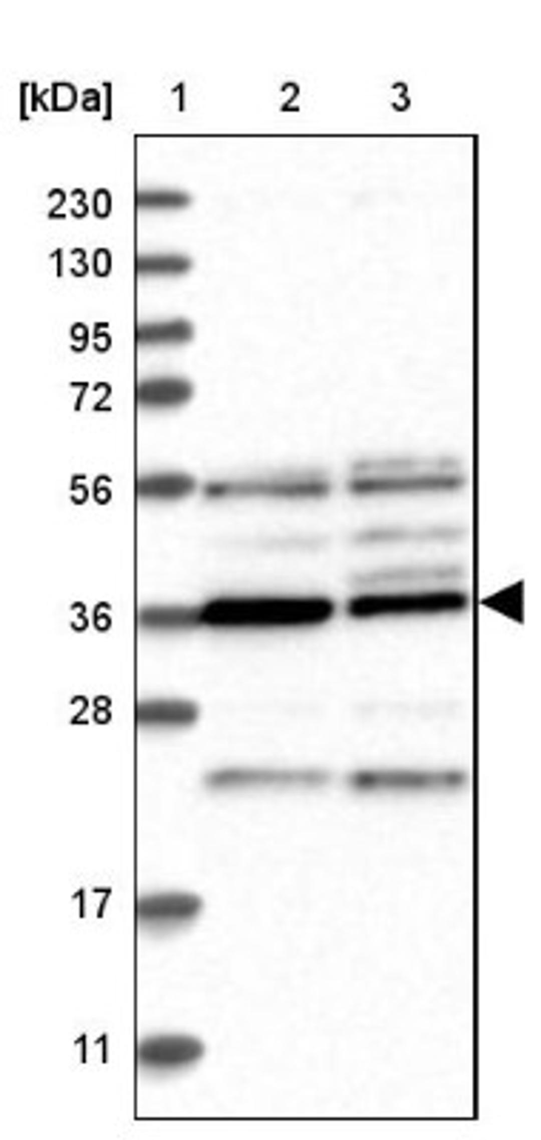 Western Blot: PAK1 interacting protein 1 Antibody [NBP1-90029] - Lane 1: Marker [kDa] 230, 130, 95, 72, 56, 36, 28, 17, 11<br/>Lane 2: Human cell line RT-4<br/>Lane 3: Human cell line U-251MG sp