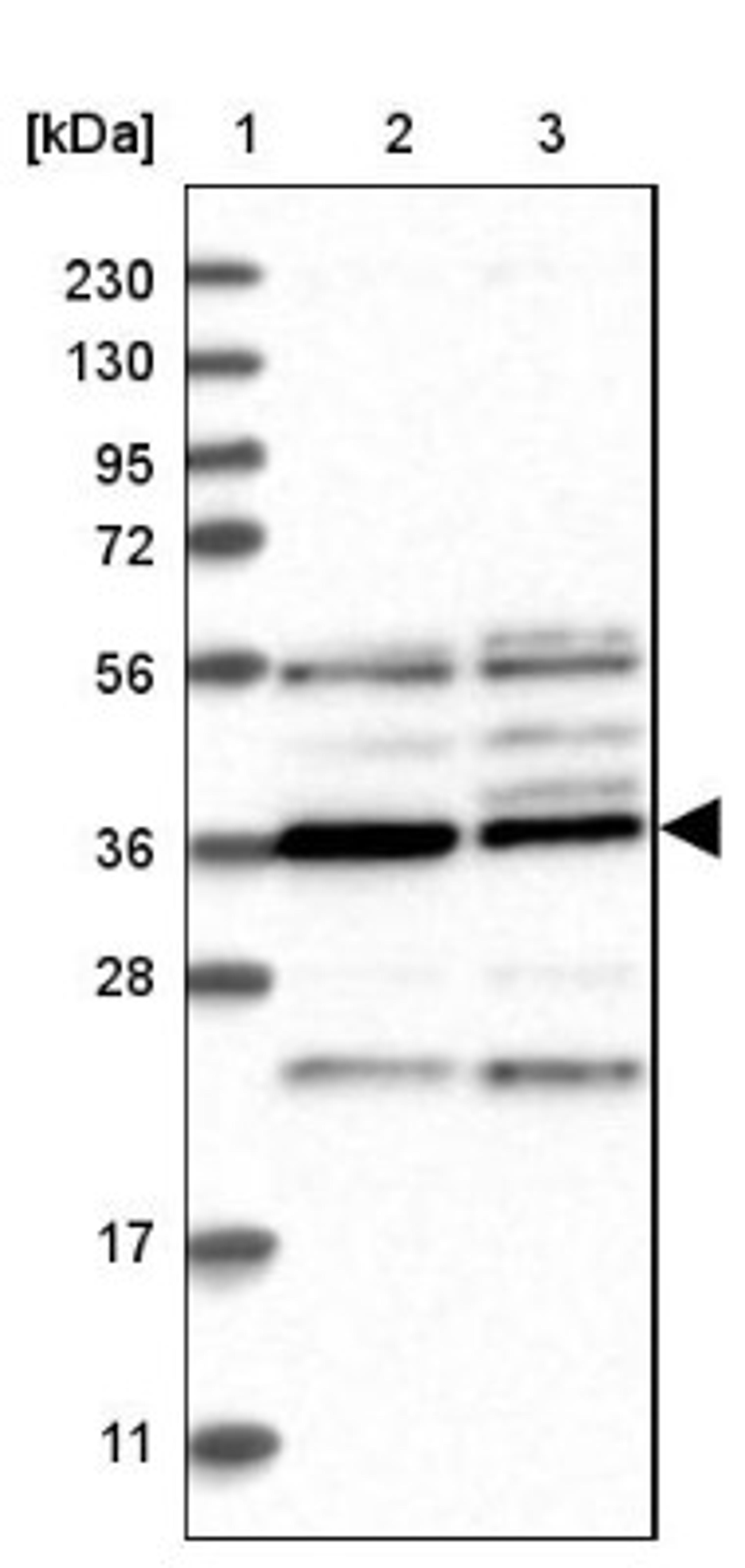 Western Blot: PAK1 interacting protein 1 Antibody [NBP1-90029] - Lane 1: Marker [kDa] 230, 130, 95, 72, 56, 36, 28, 17, 11<br/>Lane 2: Human cell line RT-4<br/>Lane 3: Human cell line U-251MG sp