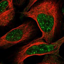 Immunocytochemistry/Immunofluorescence: C1orf194 Antibody [NBP1-90917] - Staining of human cell line U-2 OS shows positivity in nucleus but not nucleoli.