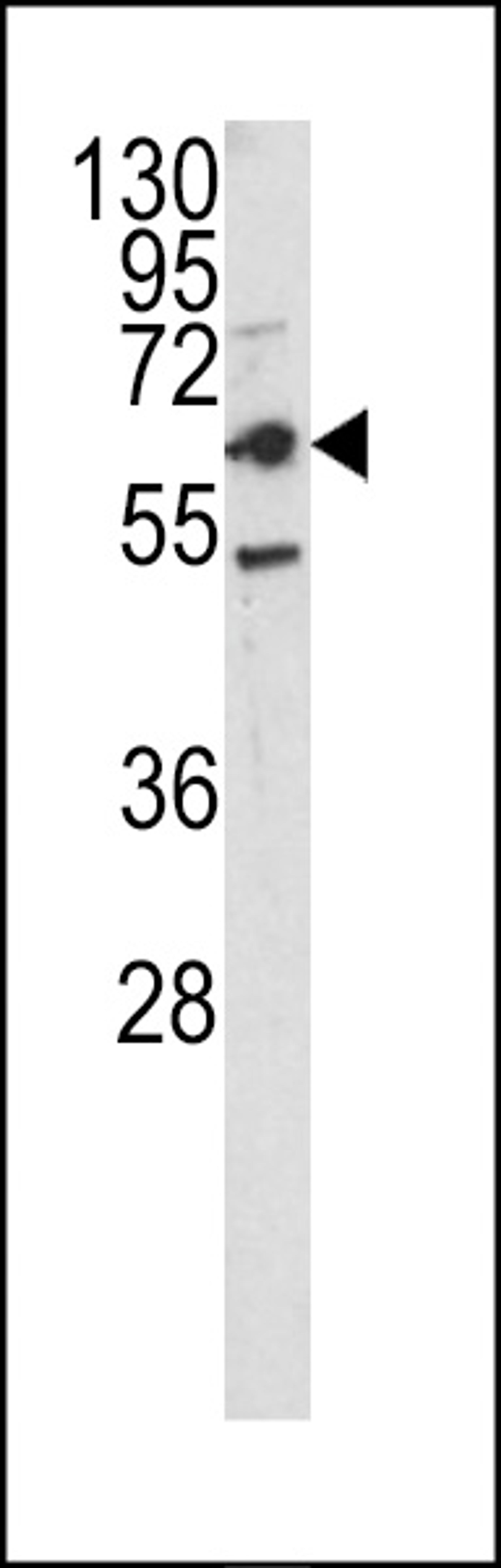 Western blot analysis of CEACAM antibody in HepG2 cell line lysates (35ug/lane)