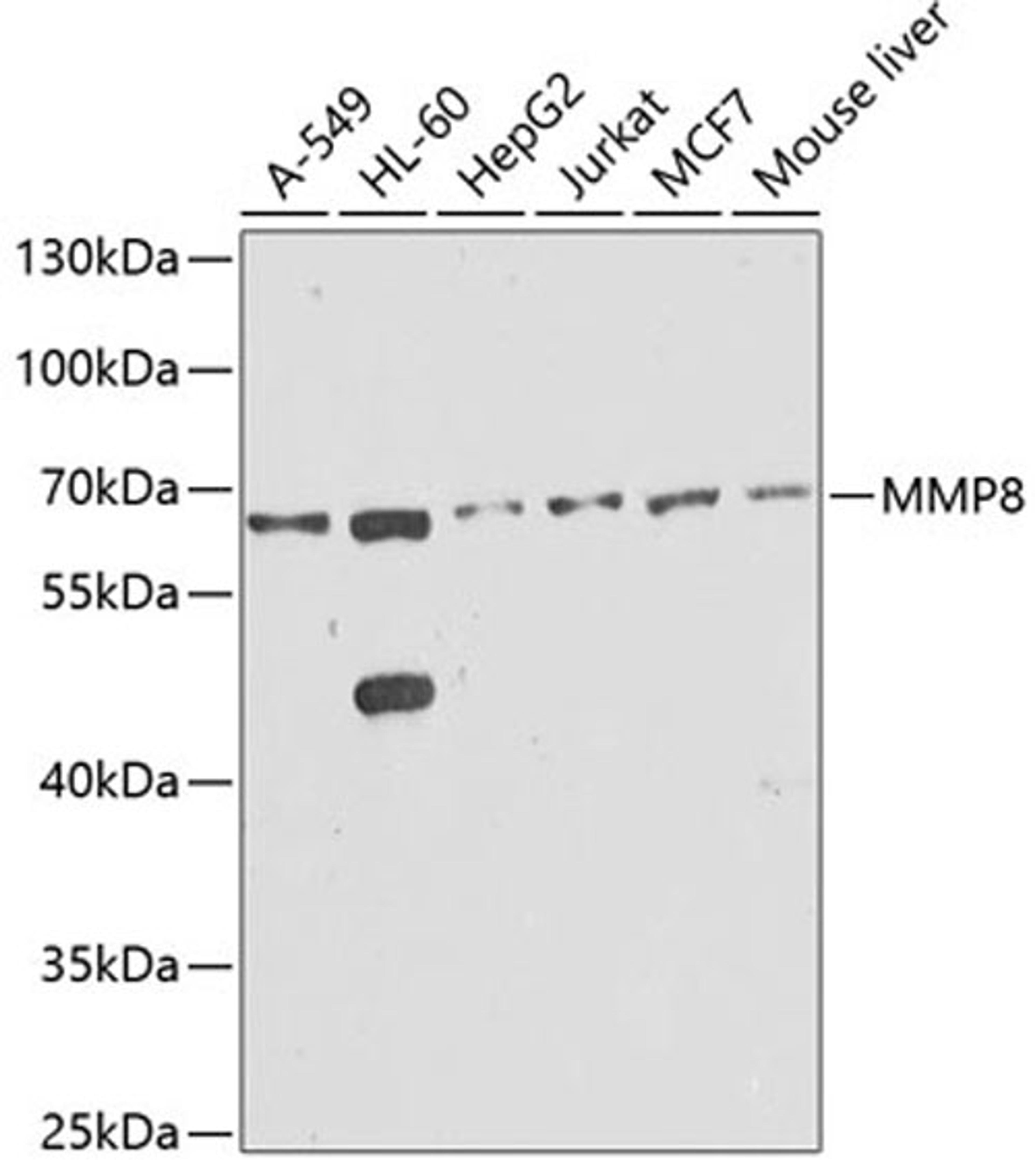 Western blot - MMP8 antibody (A1963)