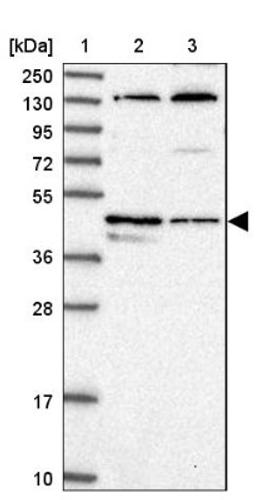 Western Blot: C14orf80 Antibody [NBP1-85864] - Lane 1: Marker [kDa] 250, 130, 95, 72, 55, 36, 28, 17, 10<br/>Lane 2: Human cell line RT-4<br/>Lane 3: Human cell line U-251MG sp