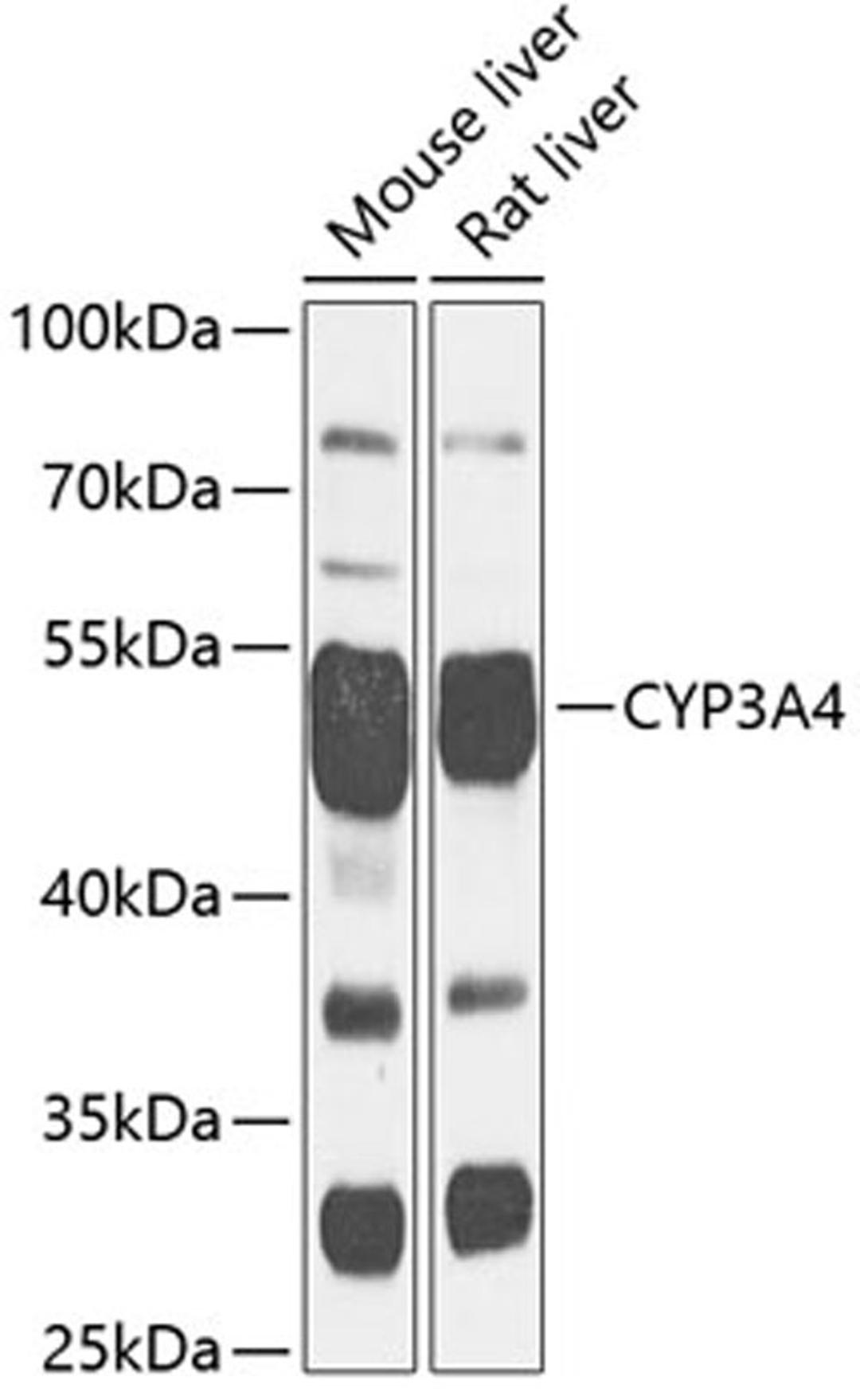 Western blot - CYP3A4 antibody (A13484)