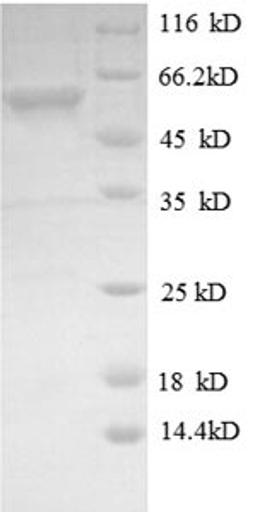 (Tris-Glycine gel) Discontinuous SDS-PAGE (reduced) with 5% enrichment gel and 15% separation gel.