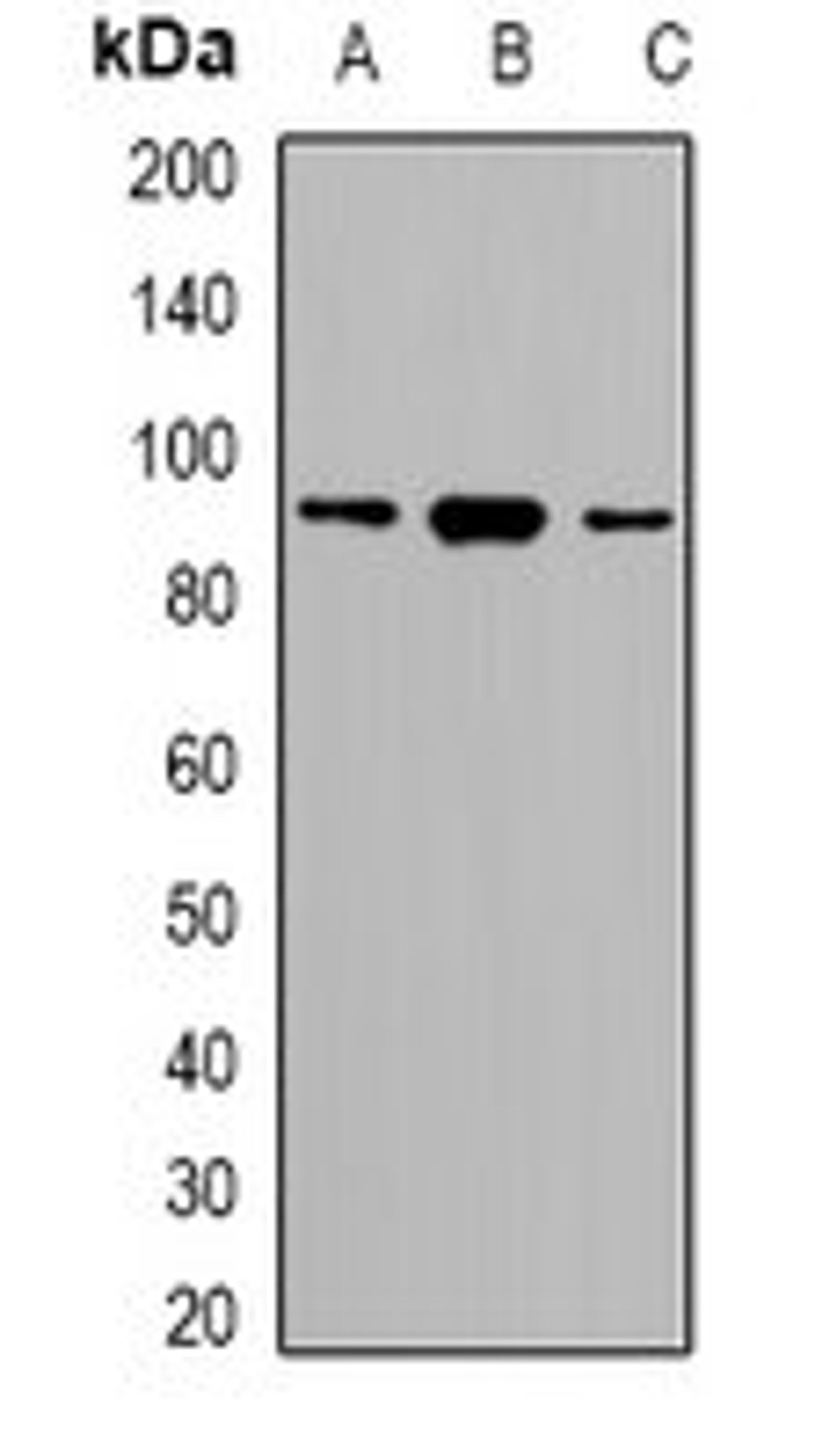 Western blot analysis of HeLa (Lane1), RAW264.7 (Lane2), H9C2 (Lane3) whole cell lysates using SRSF5 antibody