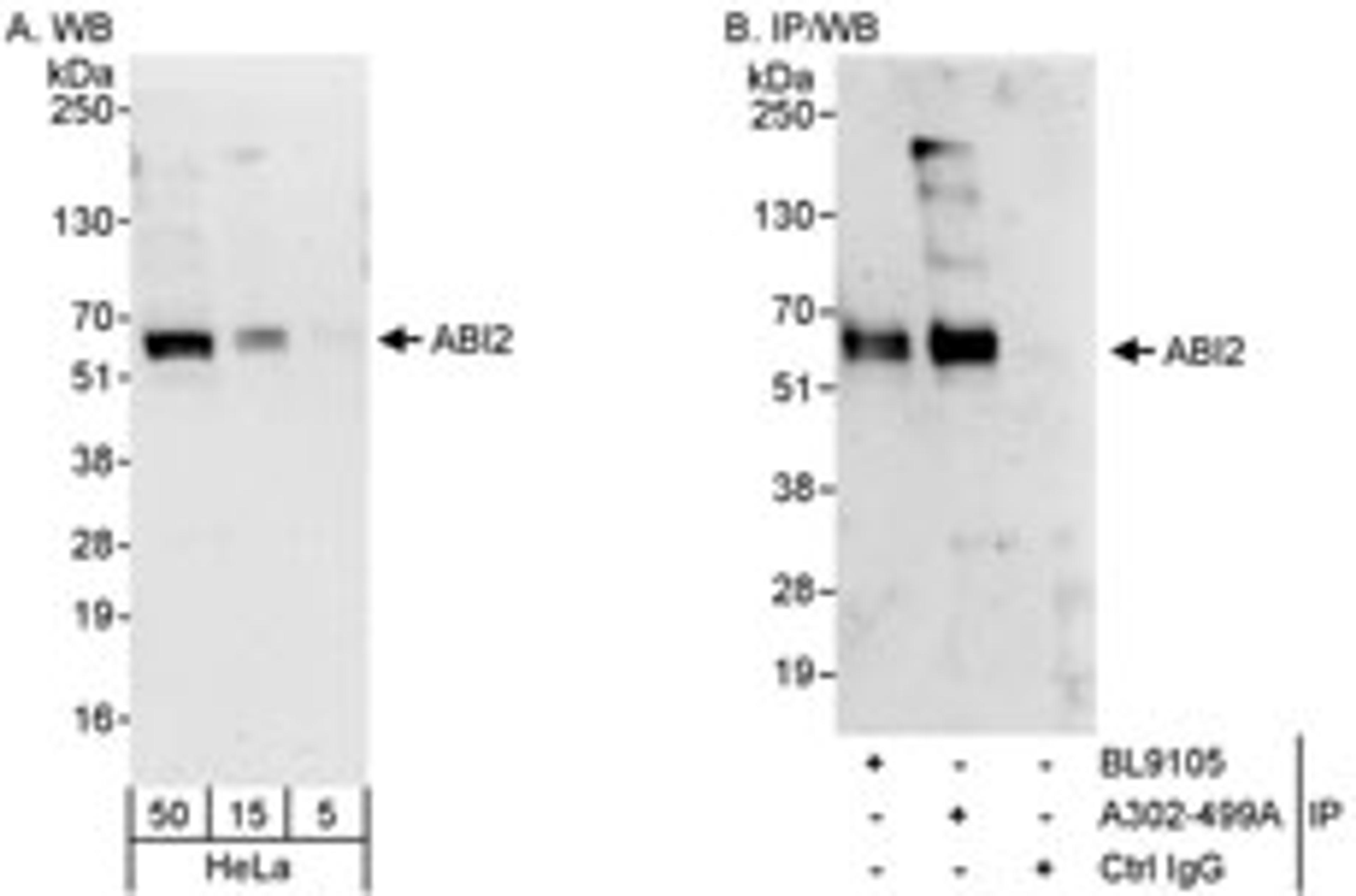 Detection of human ABI2 by western blot and immunoprecipitation.