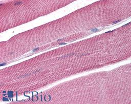 45-466 (5ug/ml) staining of paraffin embedded Human Skeletal Muscle. Steamed antigen retrieval with citrate buffer pH 6, AP-staining.