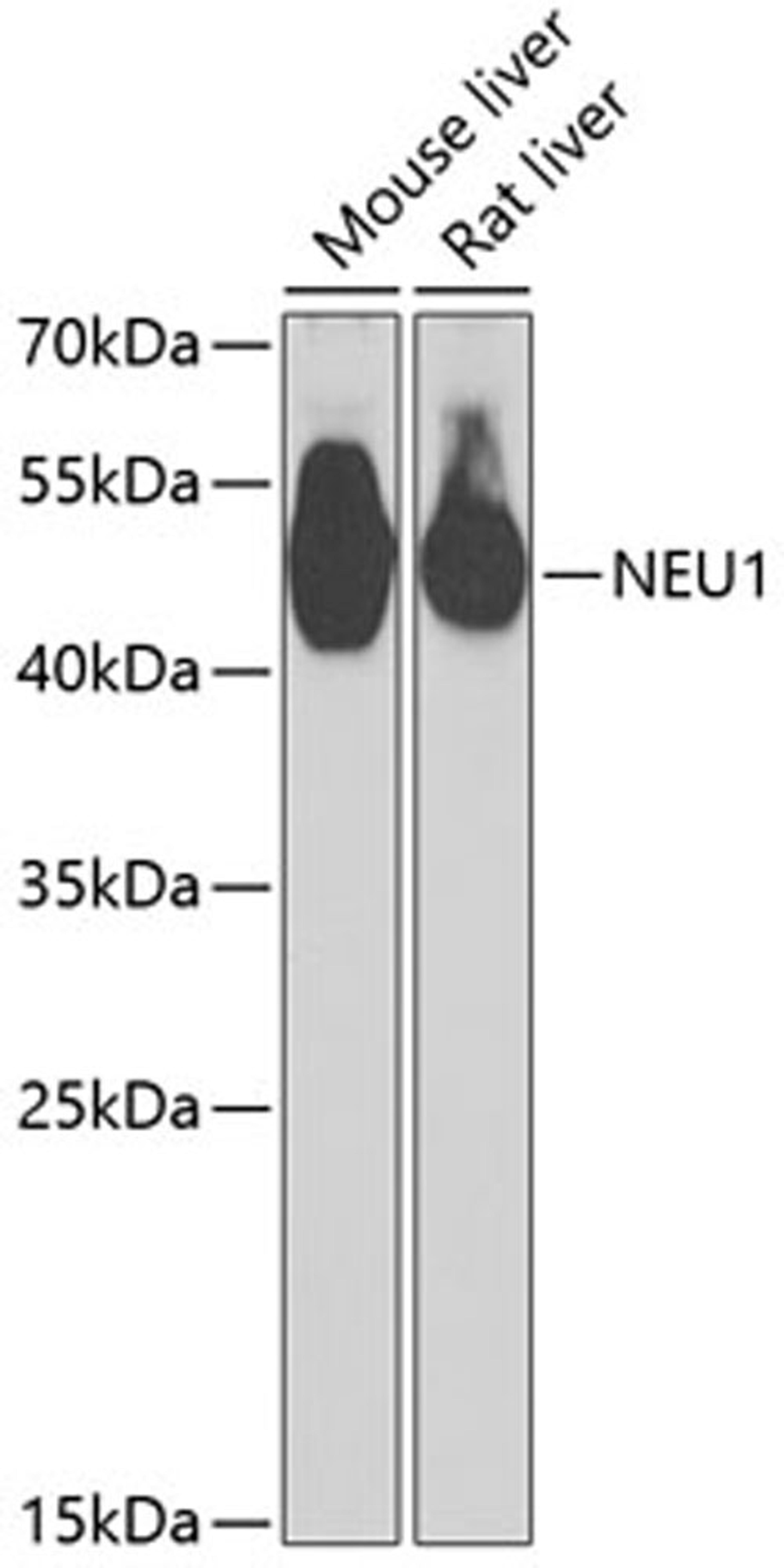 Western blot - NEU1 antibody (A6299)