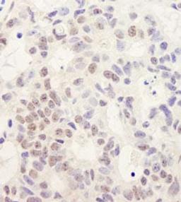 Detection of human DHX38 by immunohistochemistry.