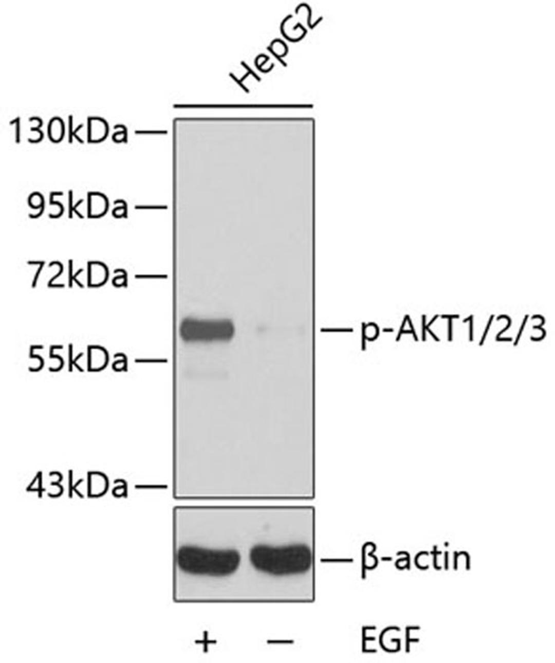 Western blot - Phospho-AKT1-Y315/AKT2-Y316/AKT3-Y312 antibody (AP0274)