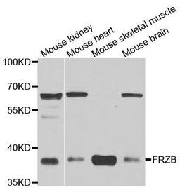 Western blot analysis of extracts of various cell lines using FRZB antibody