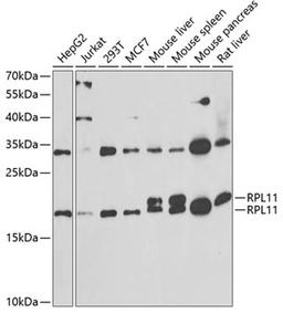 Western blot - RPL11 antibody (A6407)