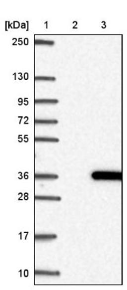 Western Blot: CUTC Antibody [NBP1-84512] - Lane 1: Marker [kDa] 250, 130, 95, 72, 55, 36, 28, 17, 10<br/>Lane 2: Negative control (vector only transfected HEK293T lysate)<br/>Lane 3: Over-expression lysate (Co-expressed with a C-terminal myc-DDK tag (~3.1 kDa) in mammalian HEK293T cells, LY414278)