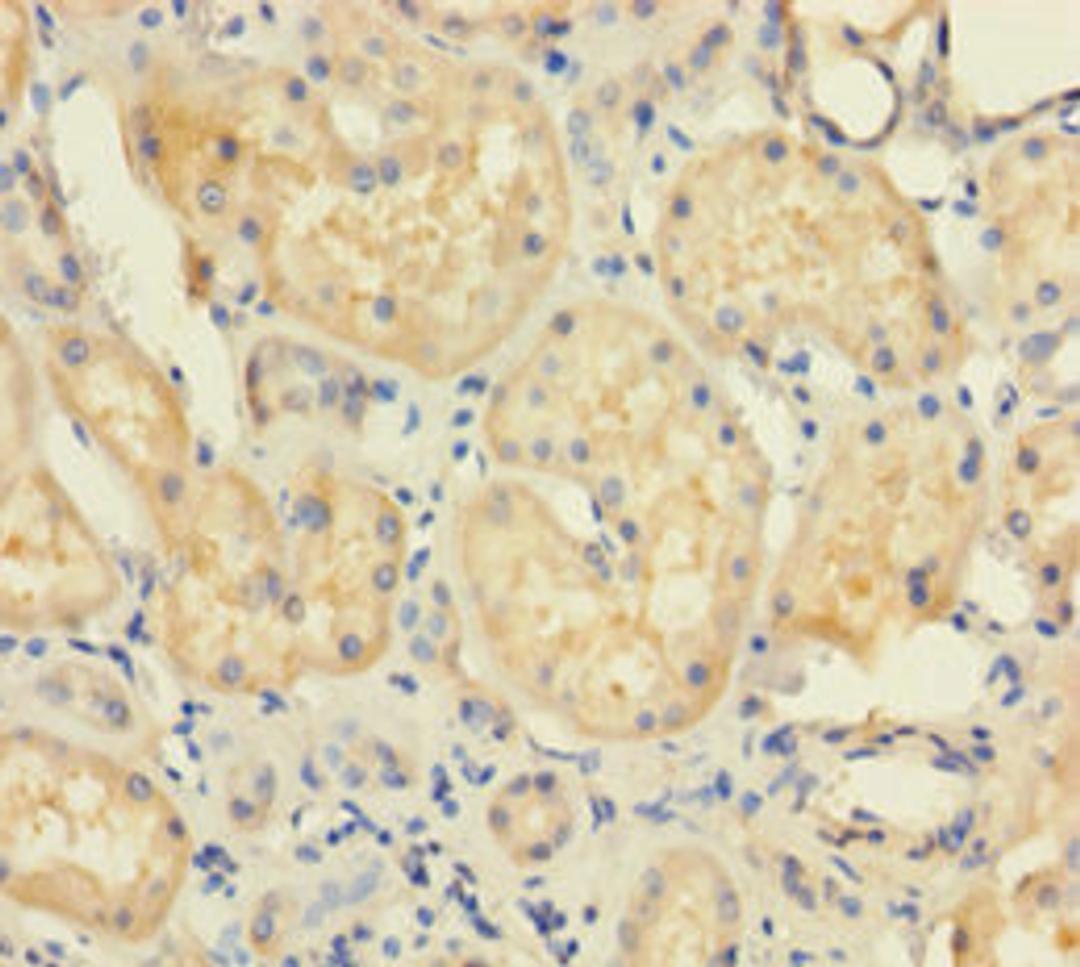 Immunohistochemistry of paraffin-embedded human kidney tissue using CSB-PA025435LA01HU at dilution of 1:100