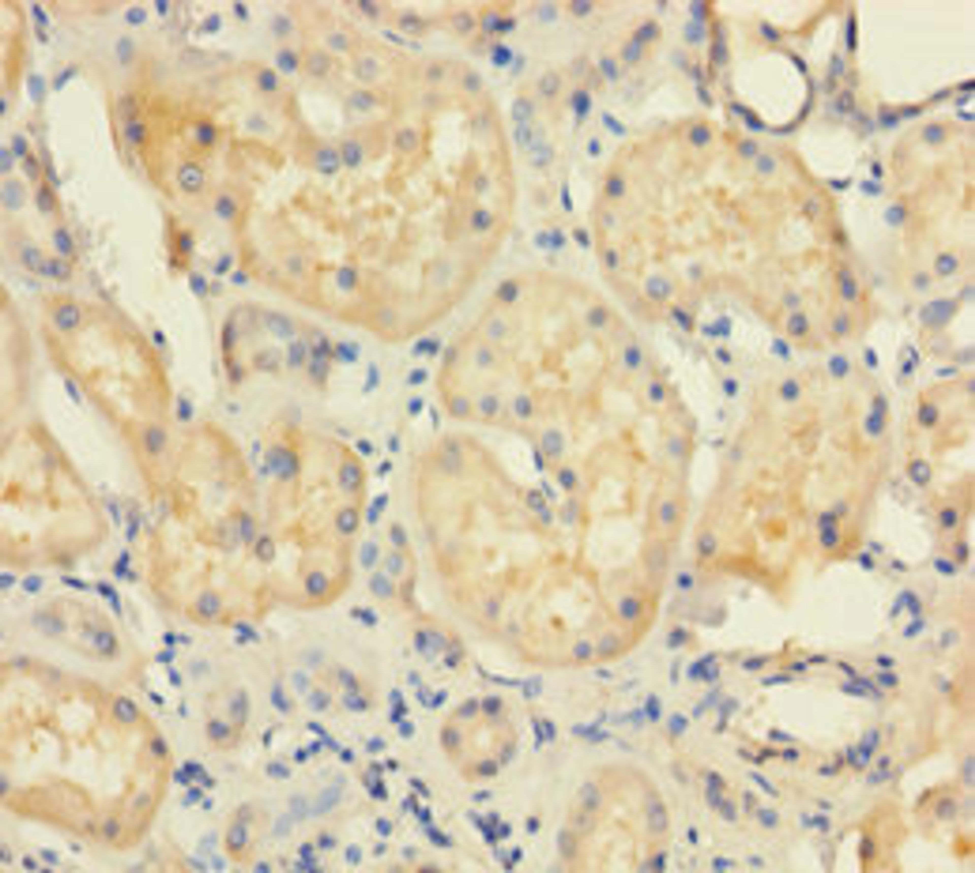 Immunohistochemistry of paraffin-embedded human kidney tissue using CSB-PA025435LA01HU at dilution of 1:100