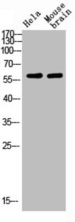 Western blot analysis of HELA MOUSE-BRAIN Cell Lysate using antibody. Secondary antibody  was diluted at 1:20000