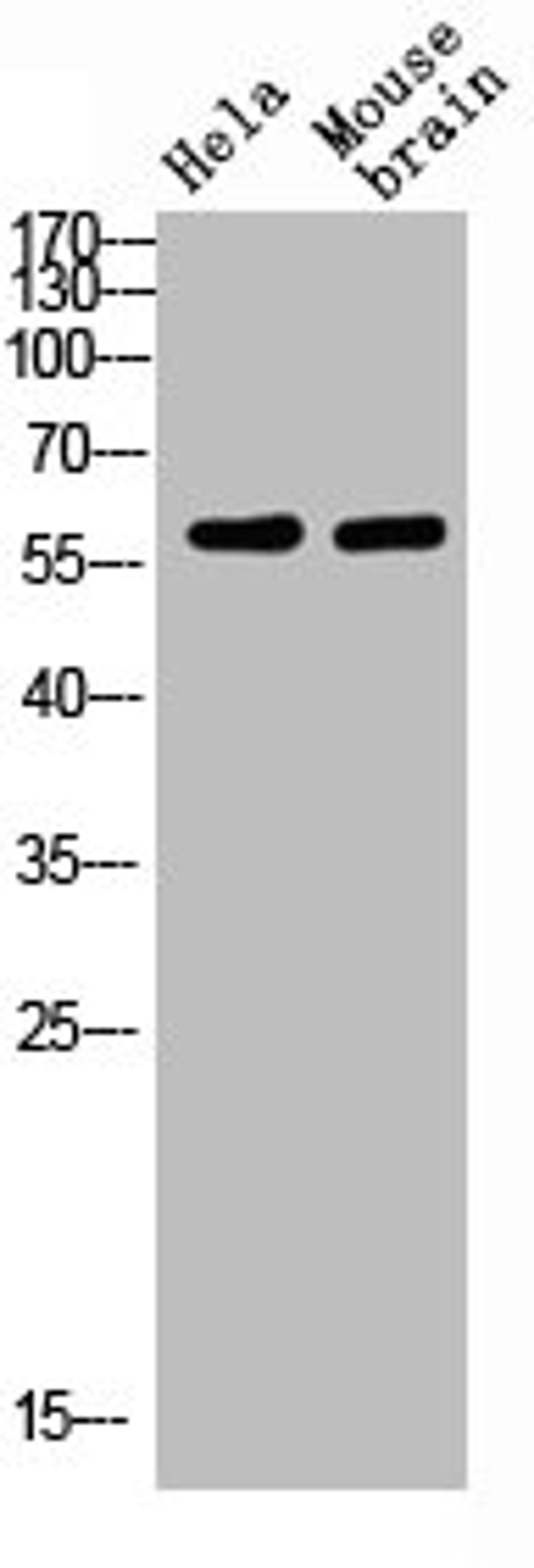 Western blot analysis of HELA MOUSE-BRAIN Cell Lysate using antibody. Secondary antibody  was diluted at 1:20000