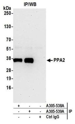 Detection of human PPA2 by western blot of immunoprecipitates.