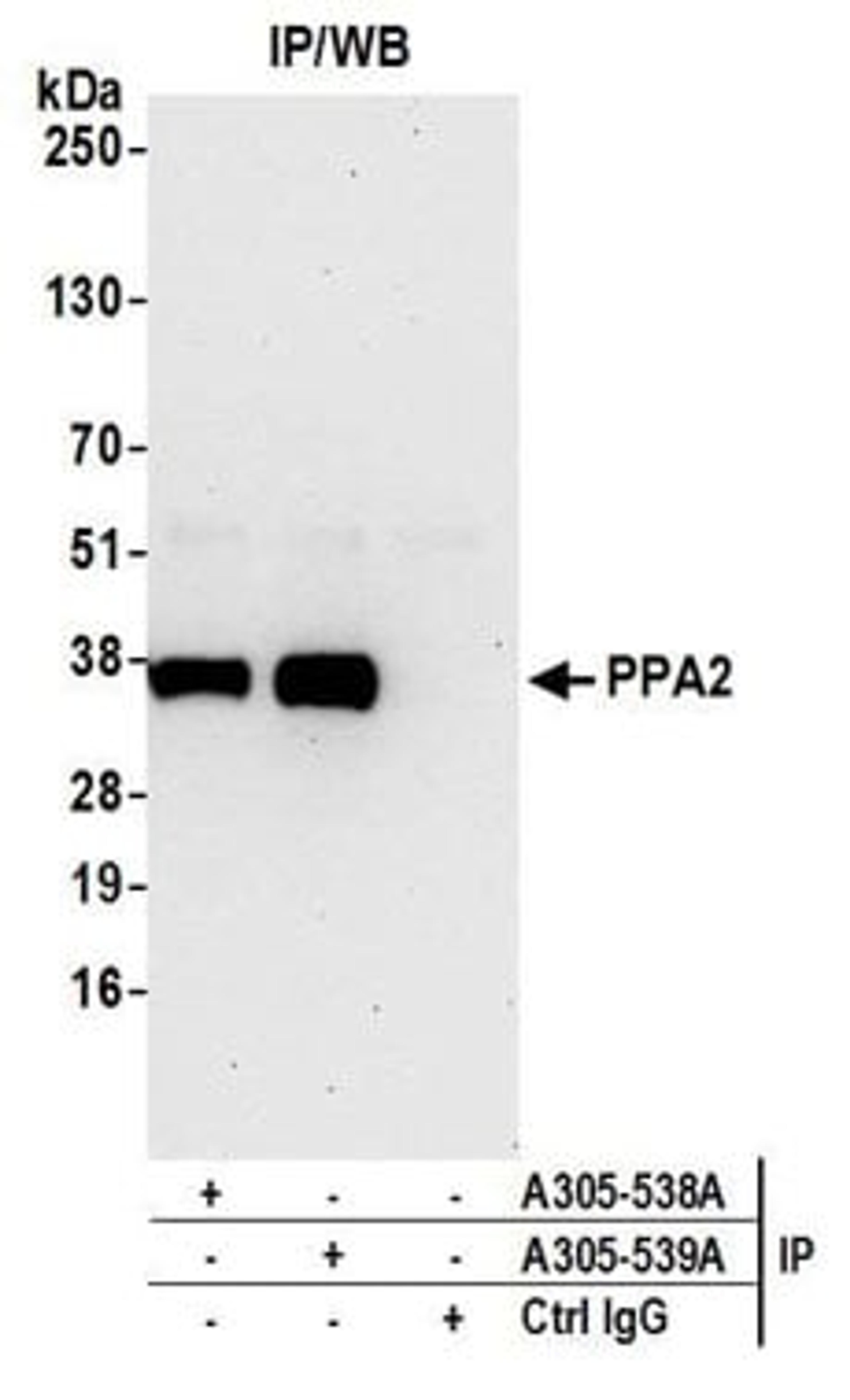 Detection of human PPA2 by western blot of immunoprecipitates.