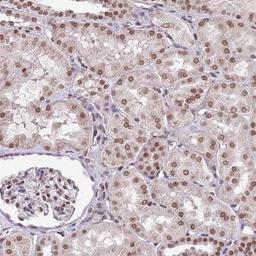 Immunohistochemistry-Paraffin: RIP140 Antibody [NBP2-13674] - Staining of human kidney shows moderate nuclear positivity in renal tubules.