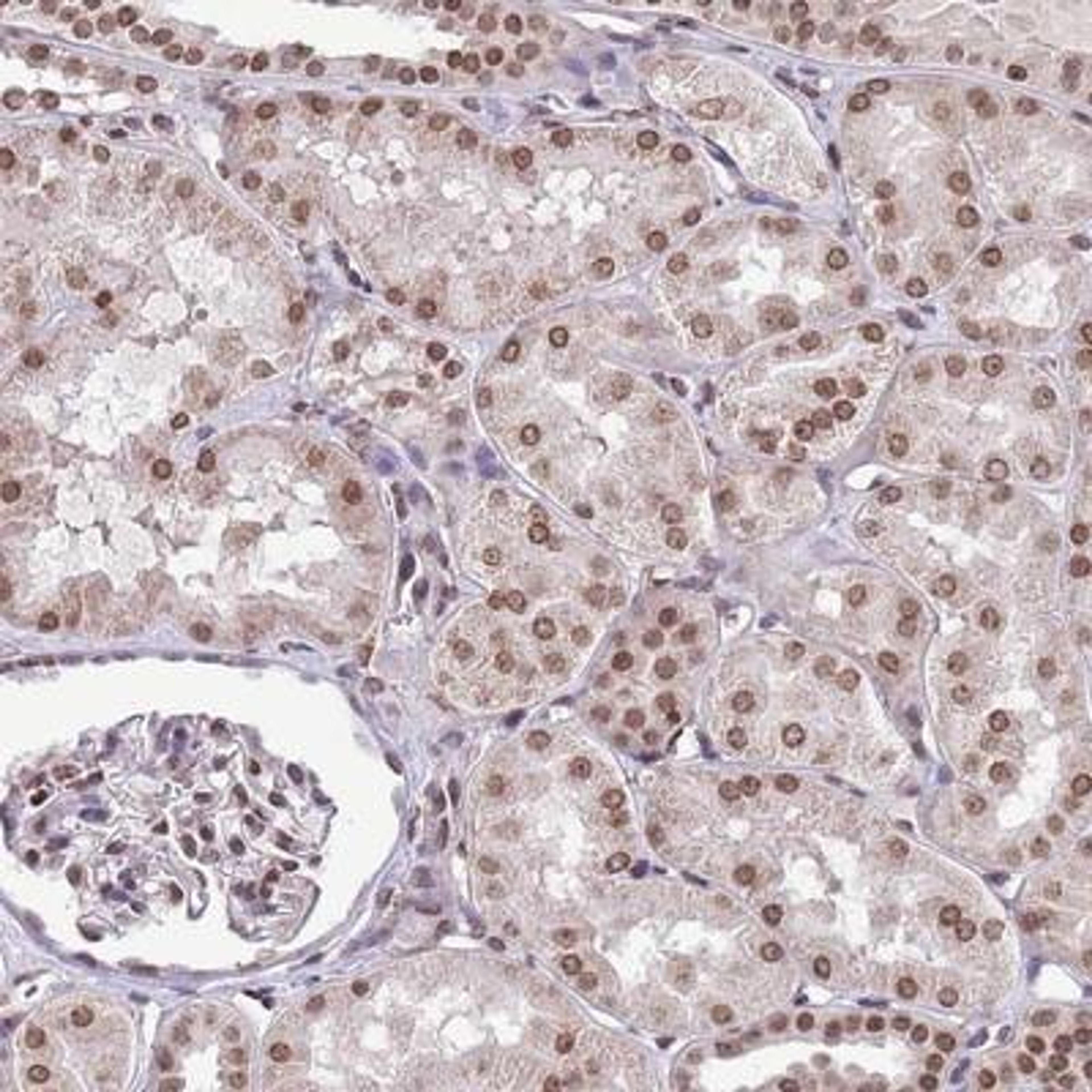 Immunohistochemistry-Paraffin: RIP140 Antibody [NBP2-13674] - Staining of human kidney shows moderate nuclear positivity in renal tubules.