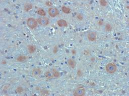 Immunohistochemical staining of rat spinal cord tissue using anti-CA125 (dilution of primary antibody - 2.5 ug/ml)