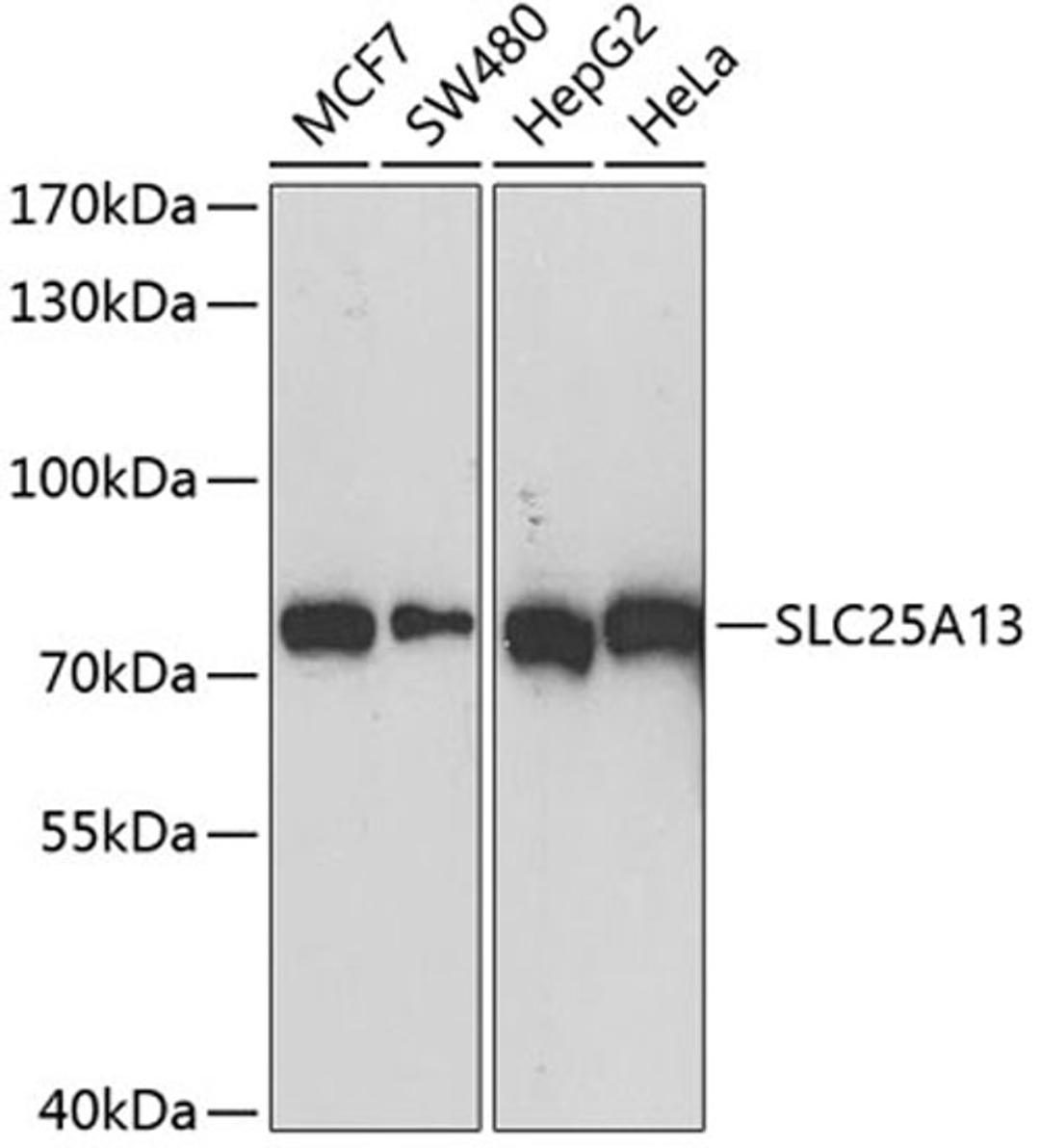 Western blot - SLC25A13 antibody (A12557)