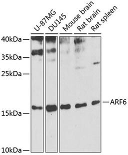 Western blot - ARF6 antibody (A0988)