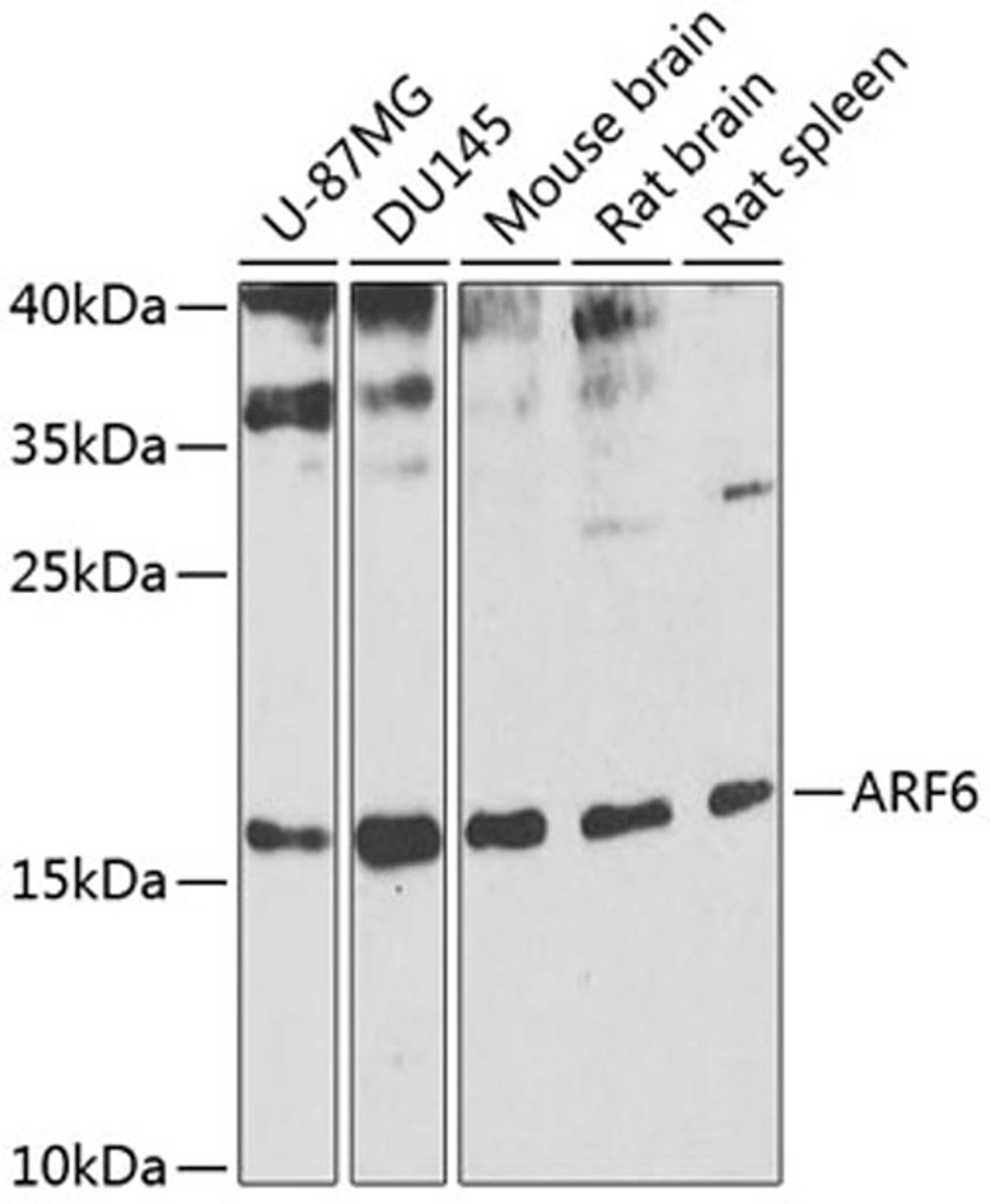 Western blot - ARF6 antibody (A0988)