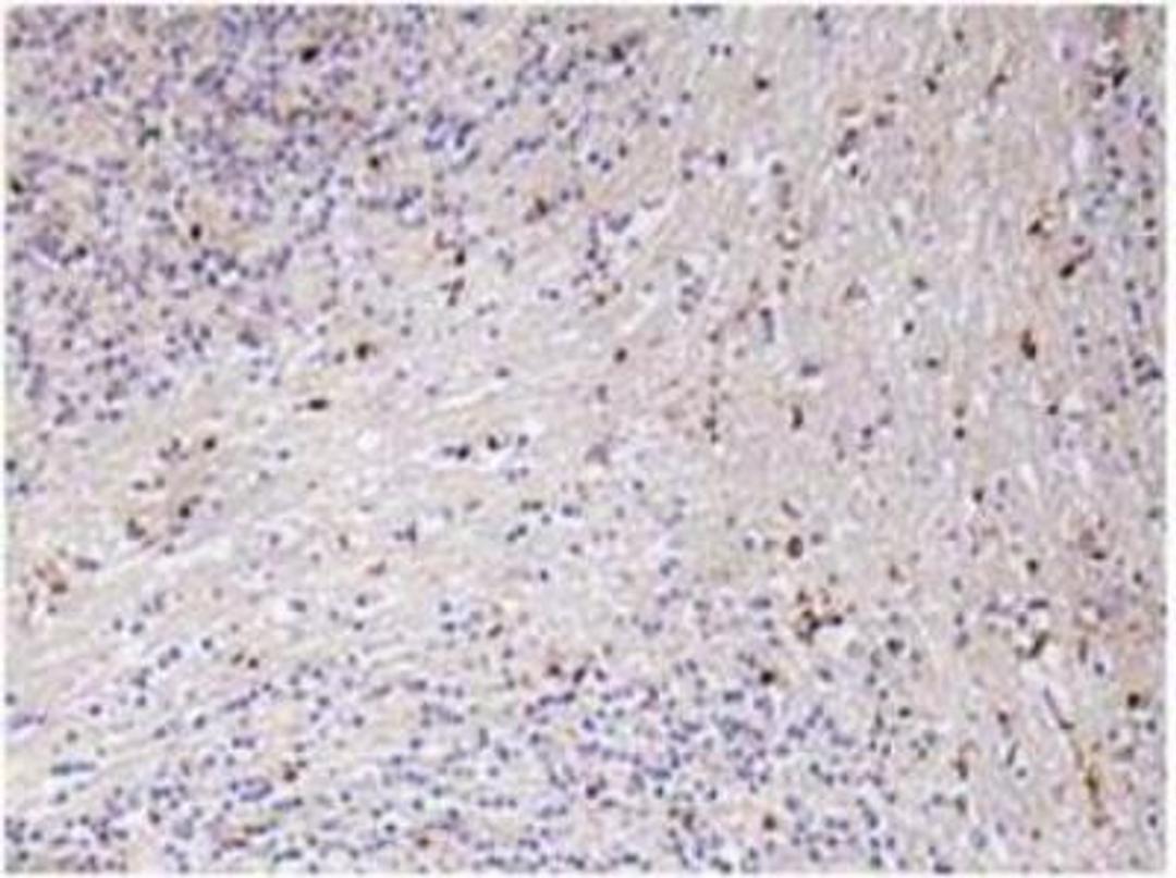 Immunohistochemistry-Paraffin: GRO alpha Antibody [NBP1-51188] - Immunohistochemistry (IHC) analyzes of GROa (P88) pAb in paraffin-embedded human brain tissue.