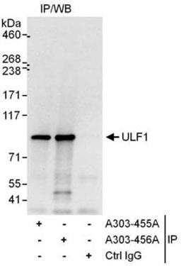 Detection of human ULF1 by western blot of immunoprecipitates.