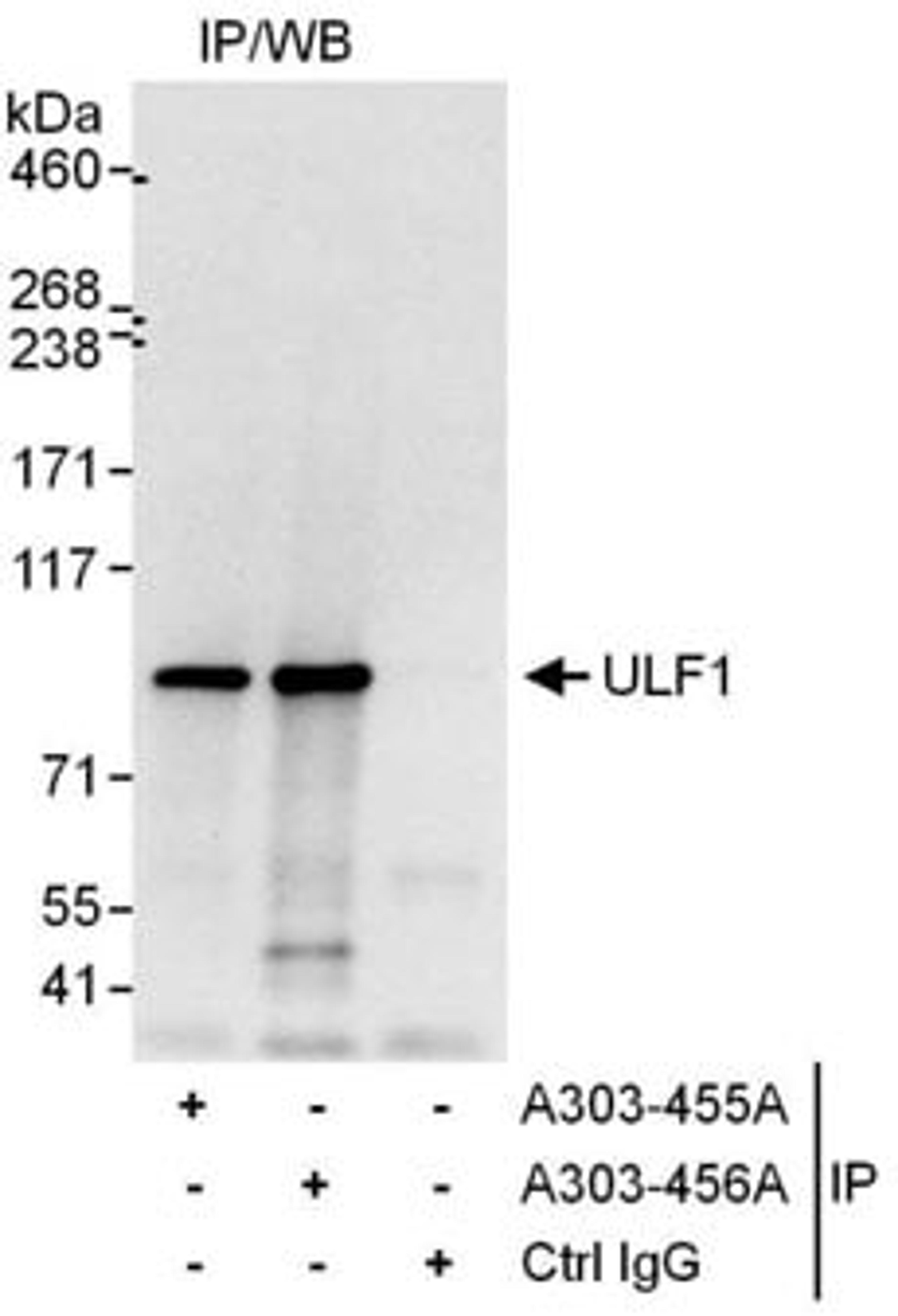 Detection of human ULF1 by western blot of immunoprecipitates.