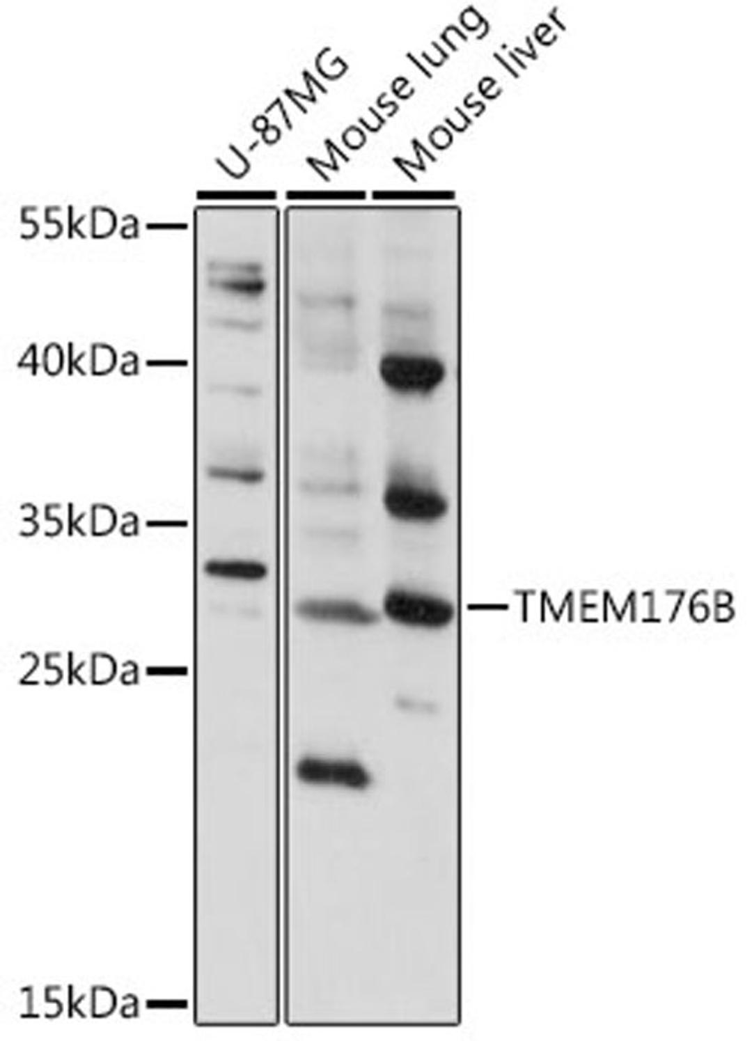 Western blot - TMEM176B antibody (A16118)