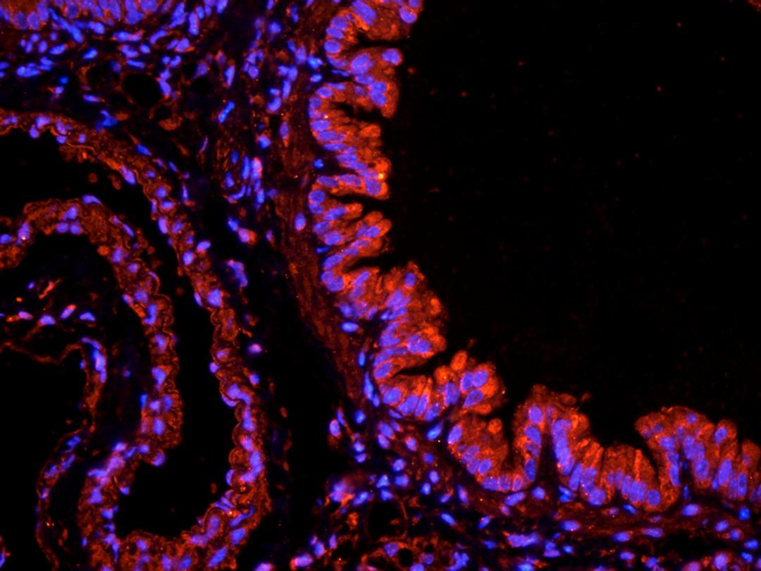 Immunofluorescence image of mouse lung tissue using iNOS antibody (dilution at 1:200)