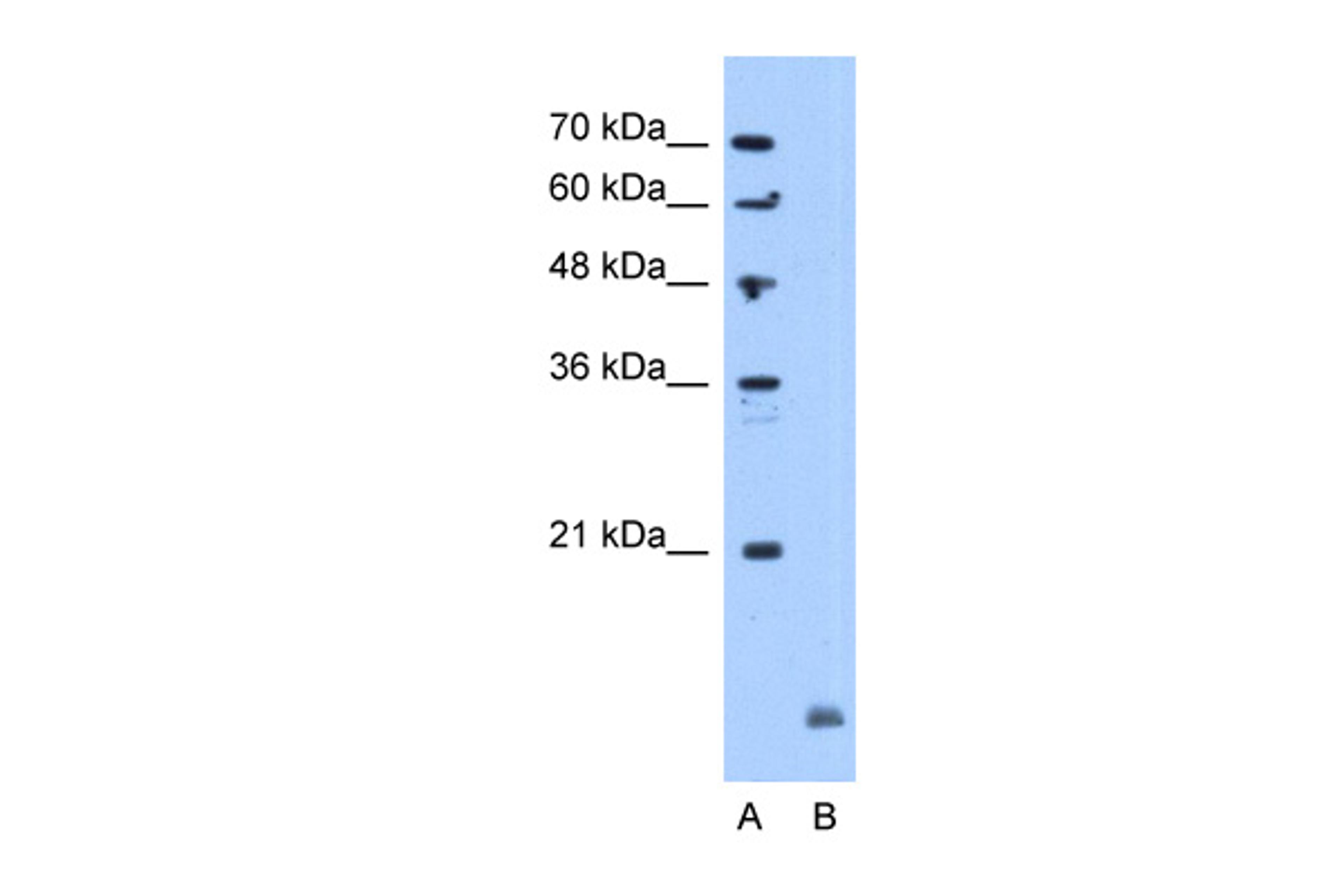 Antibody used in WB on Human Jurkat 5.0 ug/ml.