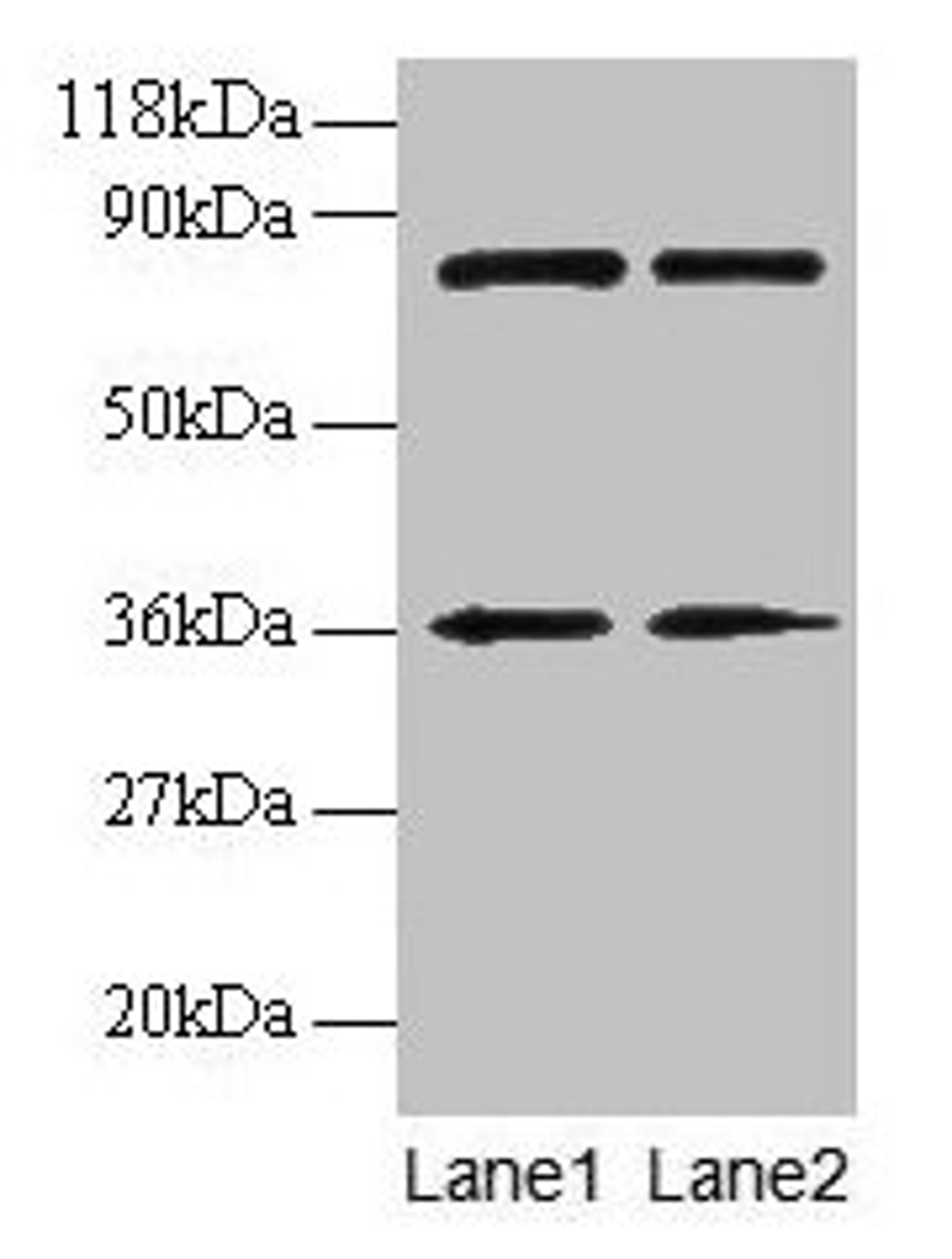 Western blot. All lanes: HNRNPH1 antibody at 2µg/ml. Lane 1: EC109 whole cell lysate. Lane 2: 293T whole cell lysate. Secondary. Goat polyclonal to rabbit IgG at 1/15000 dilution. Predicted band size: 50 kDa. Observed band size: 36 kDa