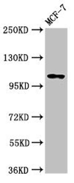 Western Blot. Positive WB detected in: MCF-7 whole cell lysate. All lanes: PSD antibody at 3.2µg/ml. Secondary. Goat polyclonal to rabbit IgG at 1/50000 dilution. Predicted band size: 110, 71 kDa. Observed band size: 110 kDa