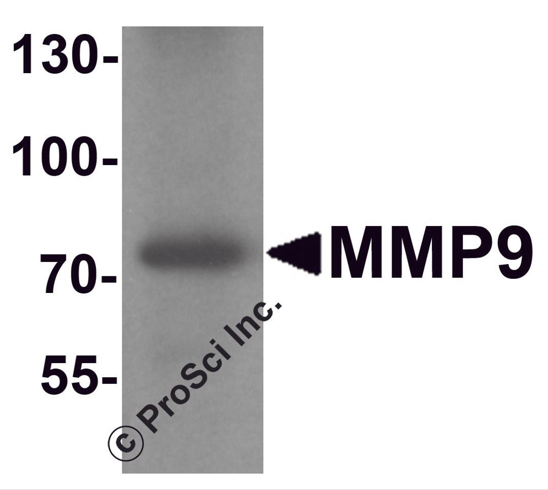 Western blot analysis of MMP9 in mouse lung tissue lysate with MMP9 antibody at 1 &#956;g/ml.