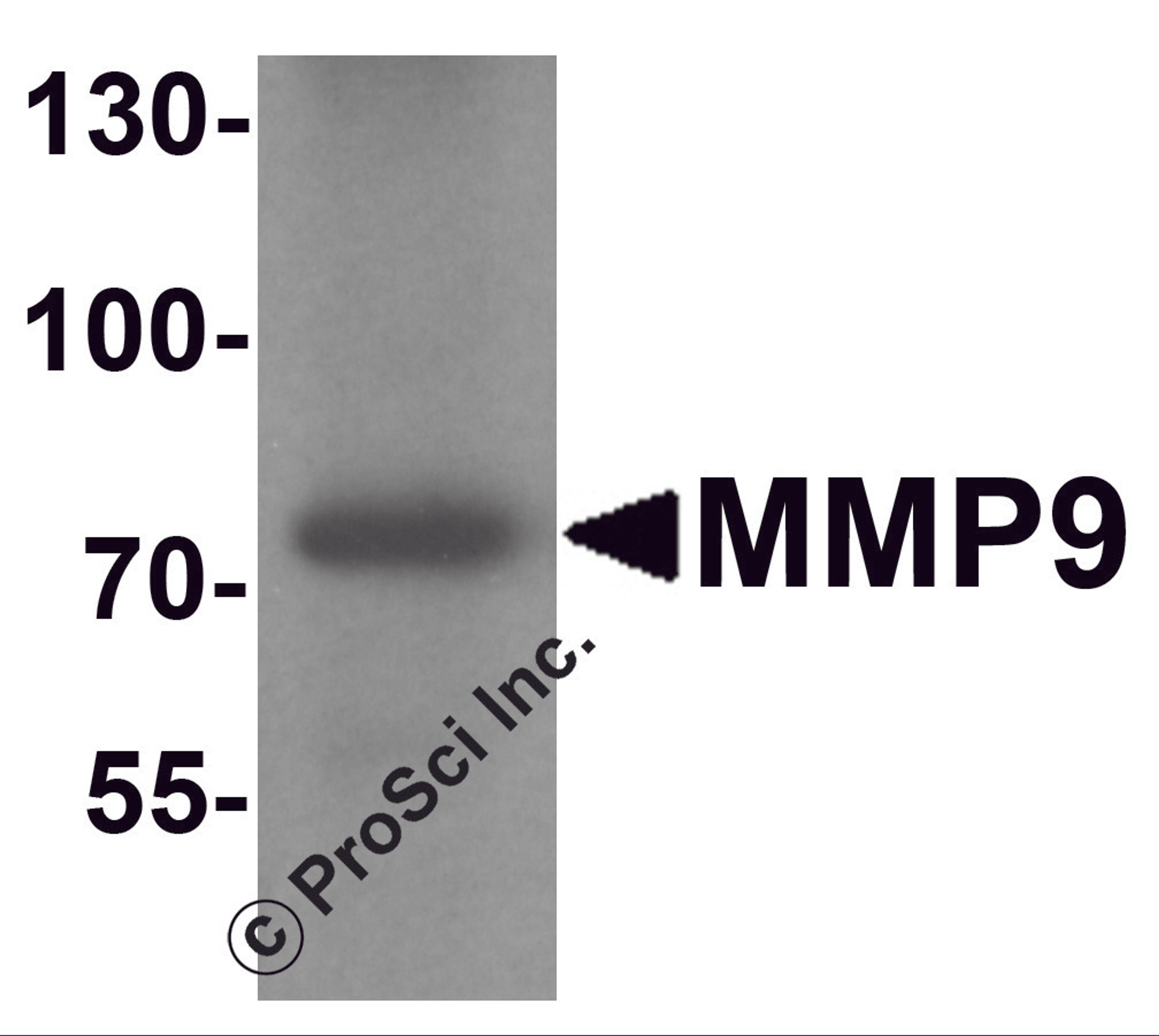 Western blot analysis of MMP9 in mouse lung tissue lysate with MMP9 antibody at 1 &#956;g/ml.