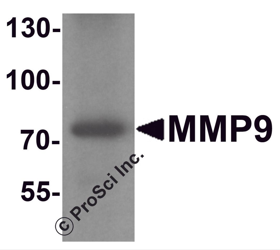 Western blot analysis of MMP9 in mouse lung tissue lysate with MMP9 antibody at 1 μg/ml.